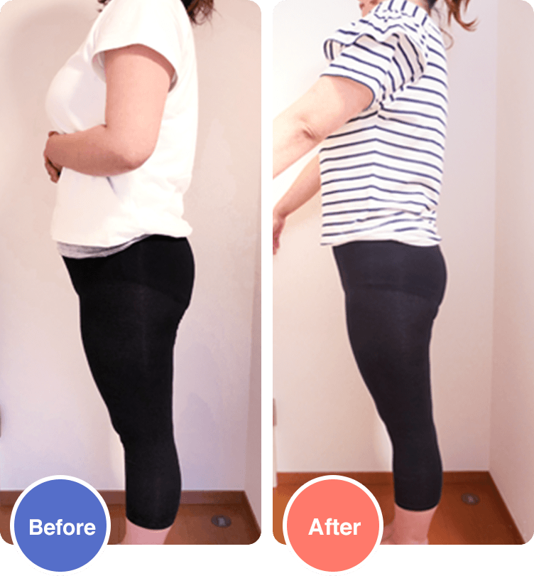 Before/After