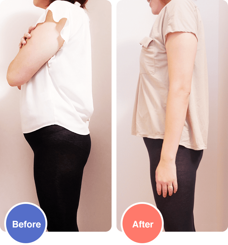 Before/After