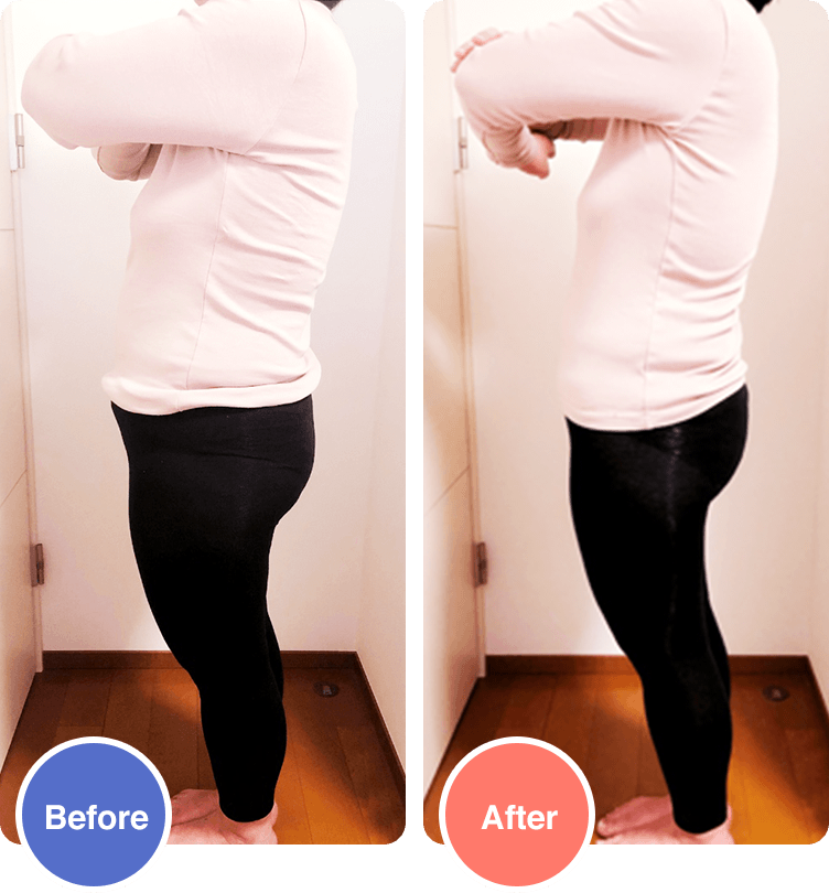 Before/After